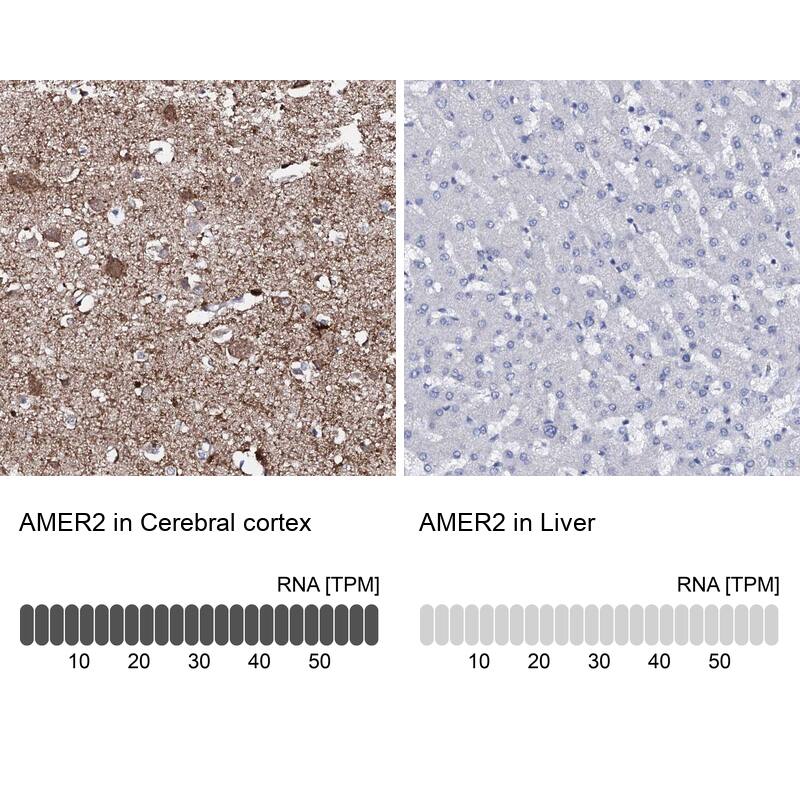 FAM123A Antibody - BSA Free Immunohistochemistry: FAM123A Antibody - BSA Free [NBP1-93907]