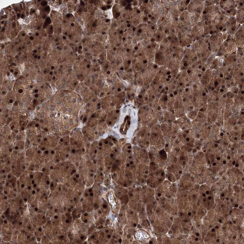ANKAR Antibody - BSA Free Immunohistochemistry-Paraffin: ANKAR Antibody [NBP1-93912]