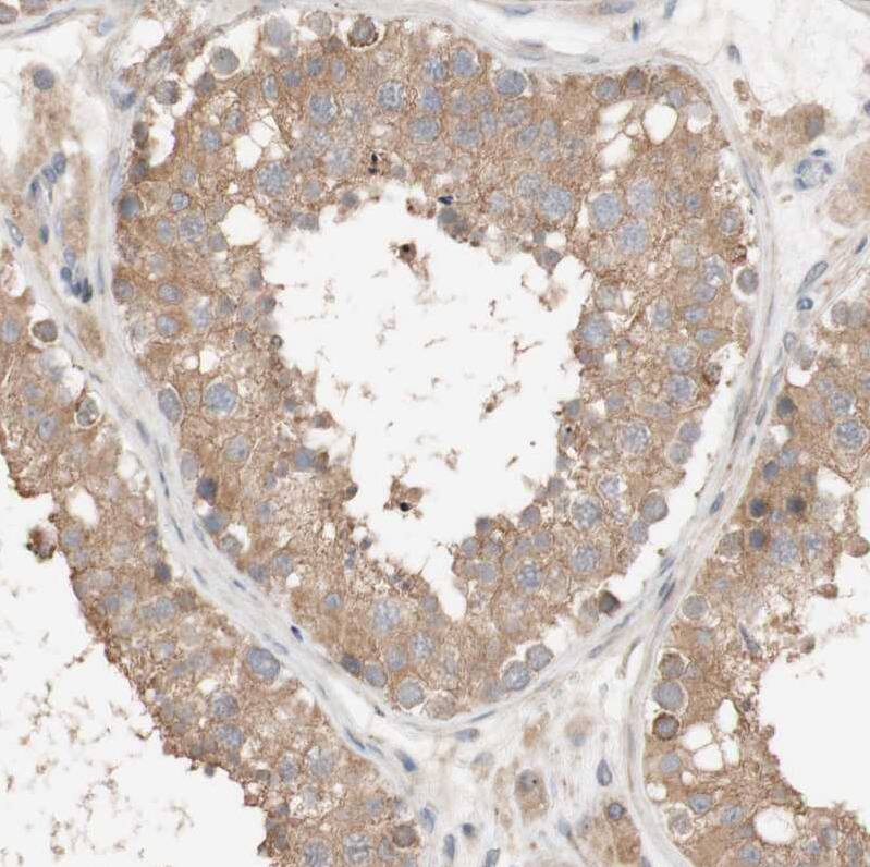 CCDC67 Antibody - BSA Free Immunohistochemistry: CCDC67 Antibody - BSA Free [NBP1-93920]