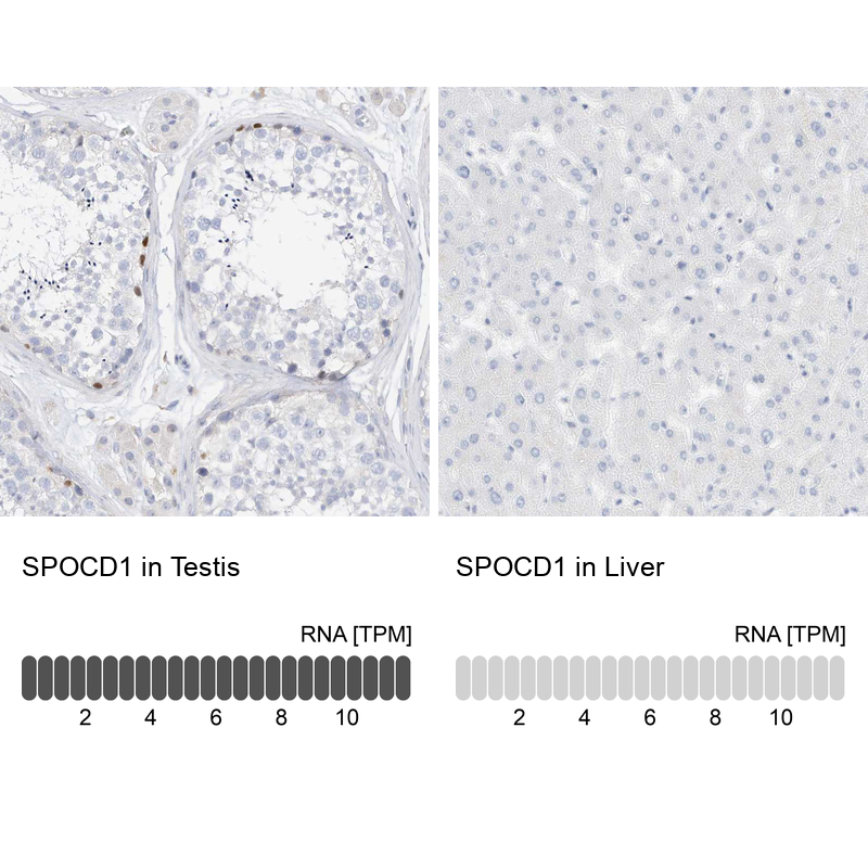 SPOCD1 Antibody - BSA Free Immunohistochemistry: SPOCD1 Antibody - BSA Free [NBP1-93922]