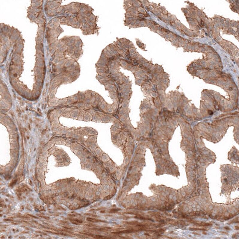 IL-17RE Antibody - BSA Free Immunohistochemistry: IL-17RE Antibody - BSA Free [NBP1-93925]