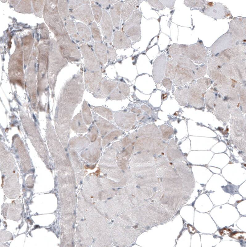 IL-17RE Antibody - BSA Free Immunohistochemistry: IL-17RE Antibody - BSA Free [NBP1-93925]