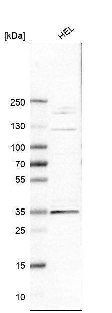ELOVL7 Antibody - BSA Free Western Blot: ELOVL7 Antibody - BSA Free [NBP1-93926]