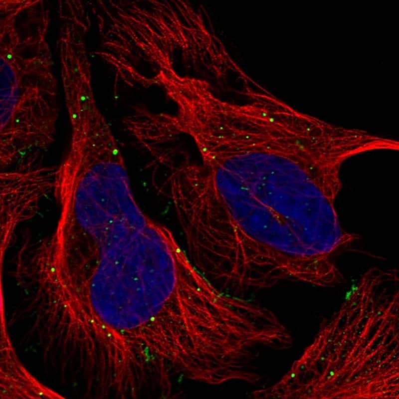 TMEM164 Antibody - BSA Free Immunocytochemistry/ Immunofluorescence: TMEM164 Antibody [NBP1-93939]