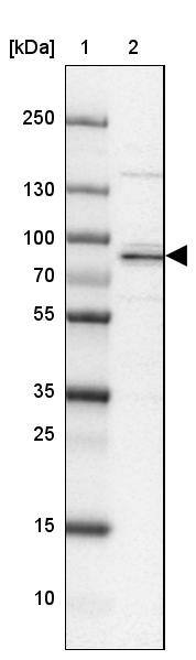 ATHL1 Antibody - BSA Free Western Blot: ATHL1 Antibody - BSA Free [NBP1-93941]