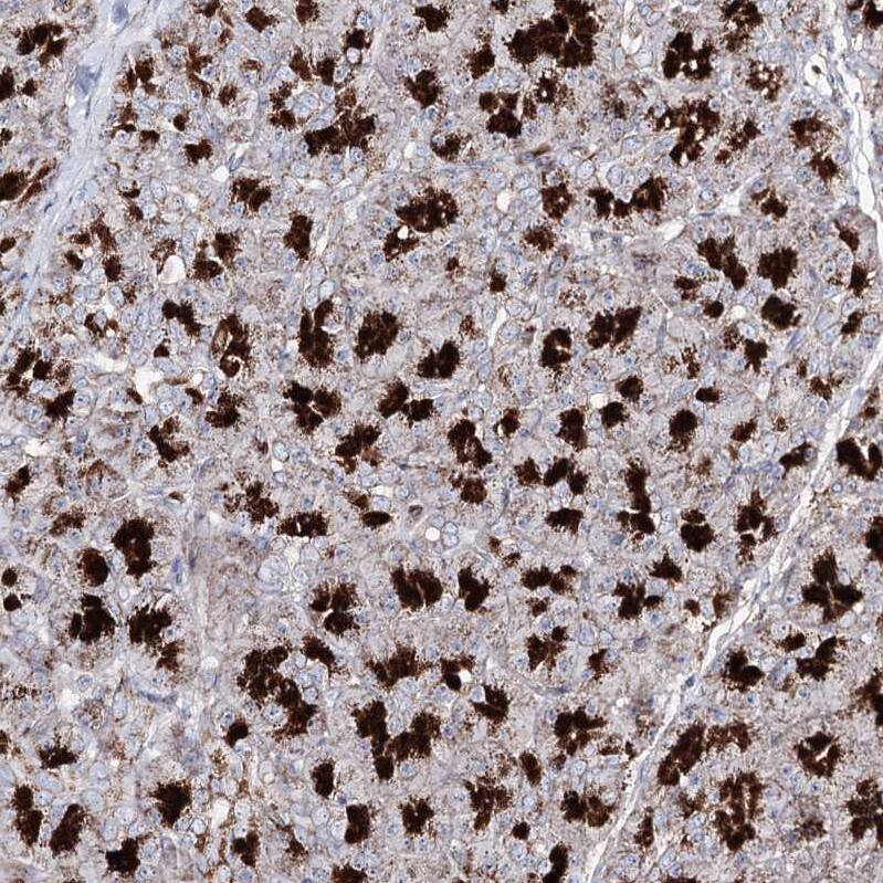 TOP6BL Antibody - BSA Free Immunohistochemistry: TOP6BL Antibody - BSA Free [NBP1-93944]