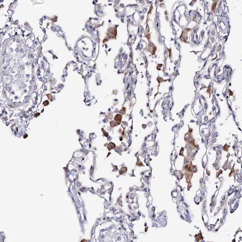 TOP6BL Antibody - BSA Free Immunohistochemistry: TOP6BL Antibody - BSA Free [NBP1-93944]