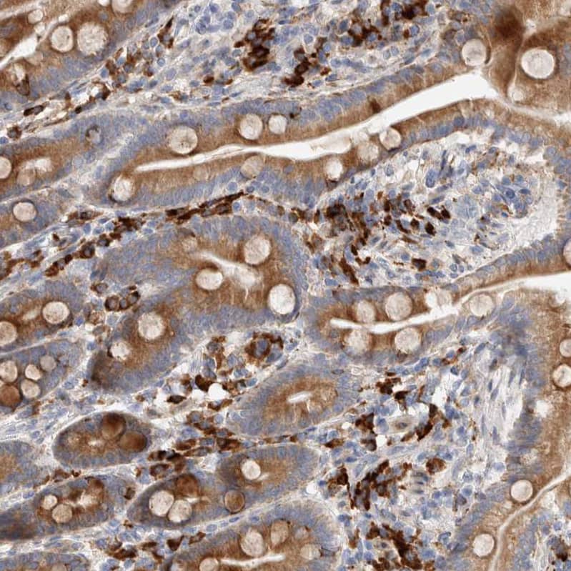 ENGASE Antibody - BSA Free Immunohistochemistry: ENGASE Antibody - BSA Free [NBP1-93948]