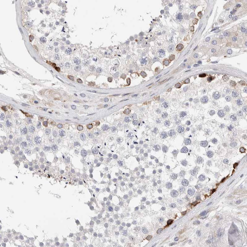 ENGASE Antibody - BSA Free Immunohistochemistry: ENGASE Antibody - BSA Free [NBP1-93948]
