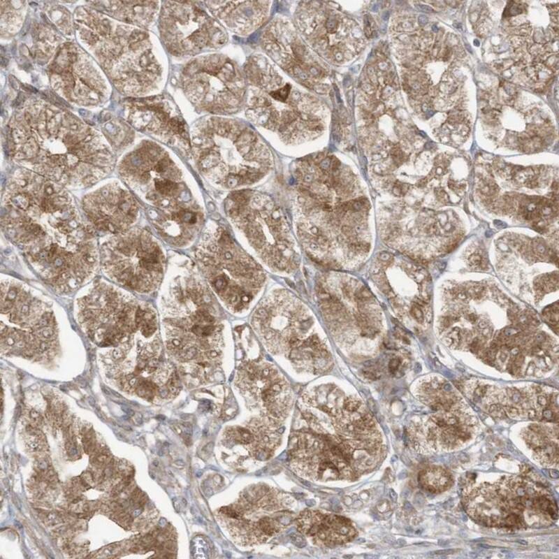 MAGIX Antibody - BSA Free Immunohistochemistry: MAGIX Antibody - BSA Free [NBP1-93951]