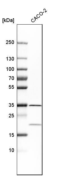 LRRC59 Antibody - BSA Free Western Blot: LRRC59 Antibody - BSA Free [NBP1-93952]