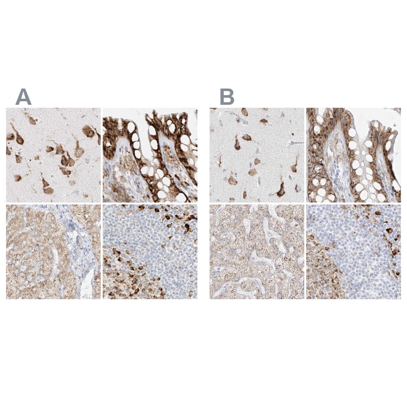 LRRC59 Antibody - BSA Free Immunohistochemistry: LRRC59 Antibody - BSA Free [NBP1-93953]