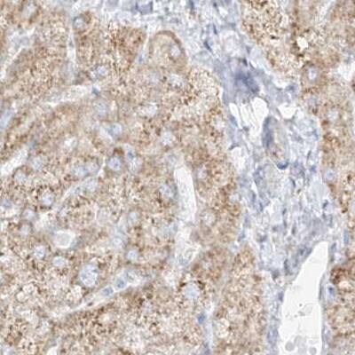 LRRC59 Antibody - BSA Free Immunohistochemistry: LRRC59 Antibody - BSA Free [NBP1-93953]