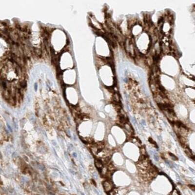 LRRC59 Antibody - BSA Free Immunohistochemistry: LRRC59 Antibody - BSA Free [NBP1-93953]