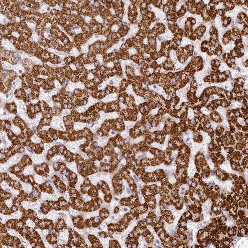 CCDC30 Antibody - BSA Free Immunohistochemistry: CCDC30 Antibody - BSA Free [NBP1-93962]