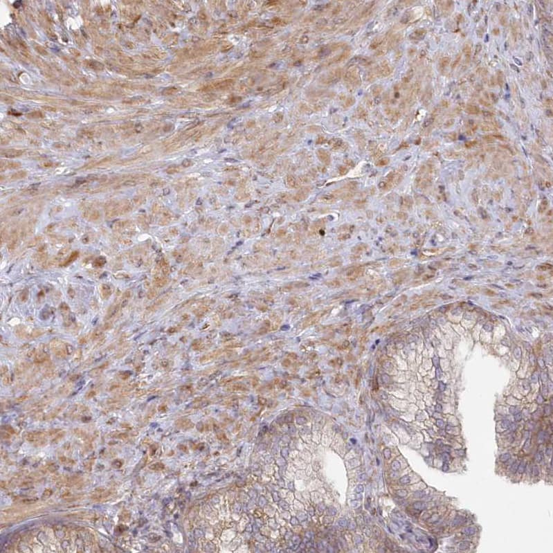 SH3PXD2B Antibody - BSA Free Immunohistochemistry: SH3PXD2B Antibody - BSA Free [NBP1-93965]
