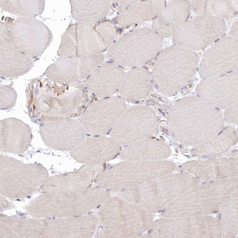 SH3PXD2B Antibody - BSA Free Immunohistochemistry: SH3PXD2B Antibody - BSA Free [NBP1-93965]