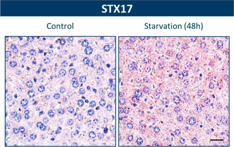 STX17 Antibody