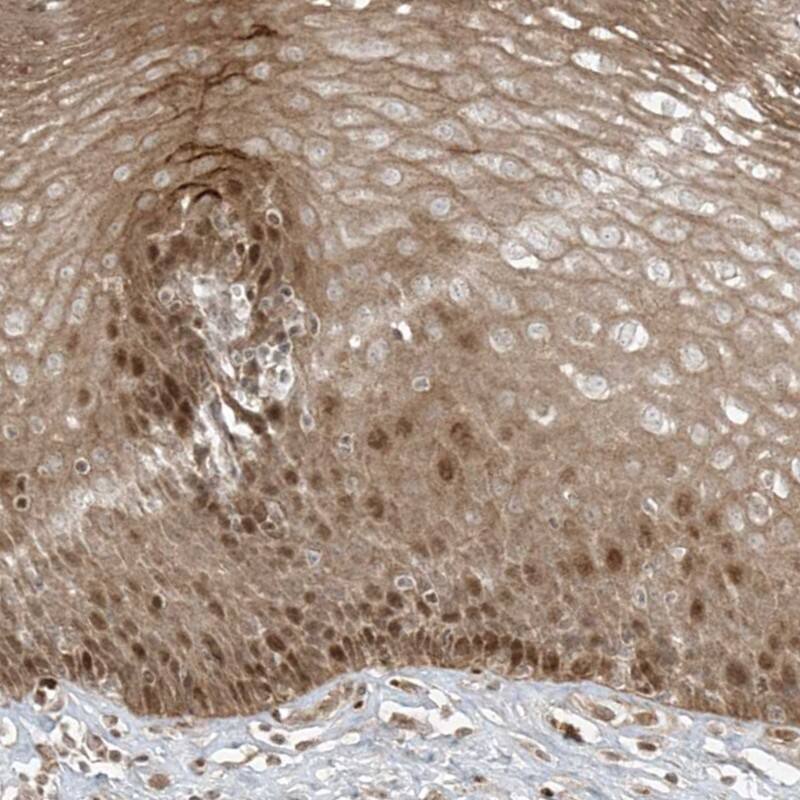 TTC22 Antibody - BSA Free Immunohistochemistry: TTC22 Antibody - BSA Free [NBP1-93970]