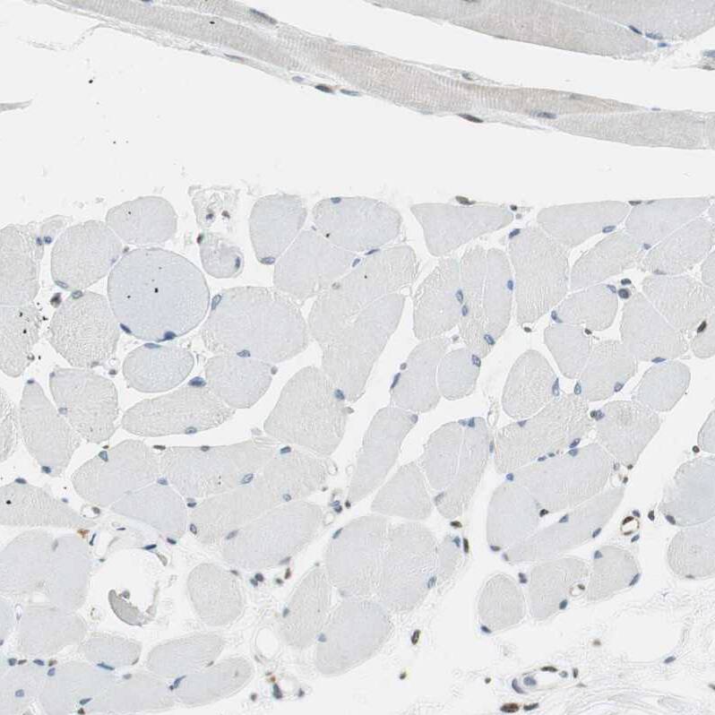 TMEM260 Antibody - BSA Free Immunohistochemistry: TMEM260 Antibody - BSA Free [NBP1-93976]