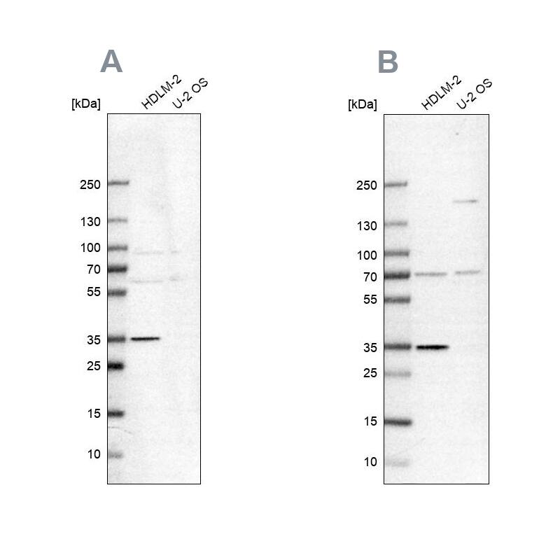 TTC19 Antibody - BSA Free Western Blot: TTC19 Antibody - BSA Free [NBP1-93979]