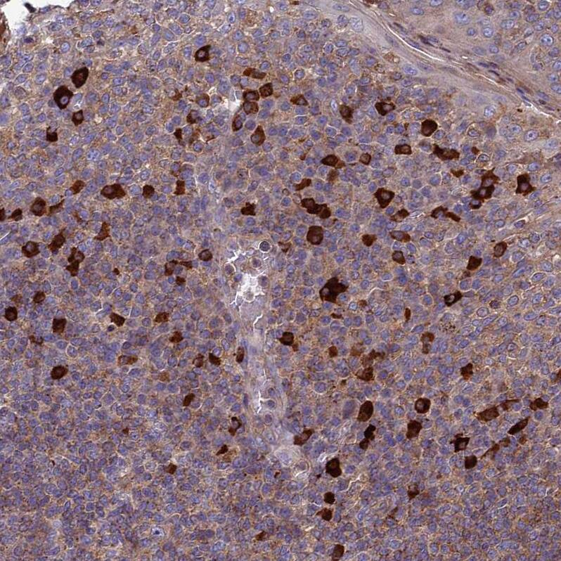 MIOS Antibody - BSA Free Immunohistochemistry: MIOS Antibody - BSA Free [NBP1-93980]