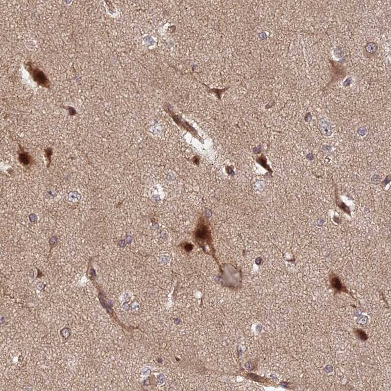 INO80D Antibody - BSA Free Immunohistochemistry: INO80D Antibody - BSA Free [NBP1-93981]