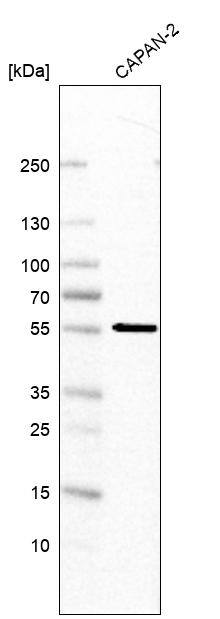 MFSD11 Antibody - BSA Free Western Blot: MFSD11 Antibody - BSA Free [NBP1-93984]