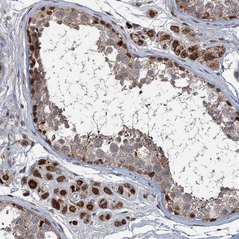 RITA Antibody - BSA Free Immunohistochemistry: RITA Antibody - BSA Free [NBP1-94003]
