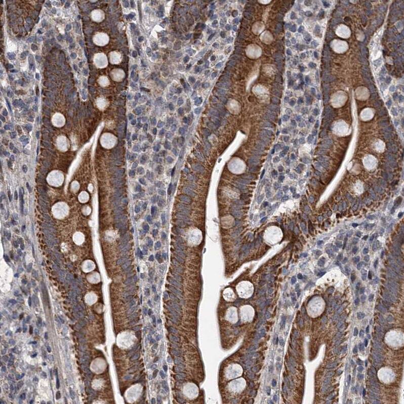 RITA Antibody - BSA Free Immunohistochemistry: RITA Antibody - BSA Free [NBP1-94003]