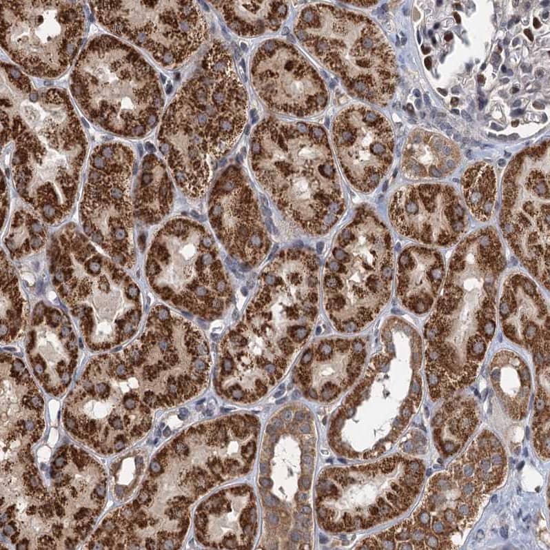 RITA Antibody - BSA Free Immunohistochemistry: RITA Antibody - BSA Free [NBP1-94003]