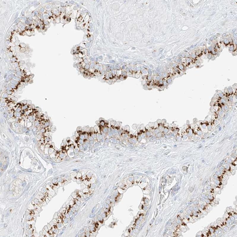TMEM87B Antibody - BSA Free Immunohistochemistry: TMEM87B Antibody - BSA Free [NBP1-94006]