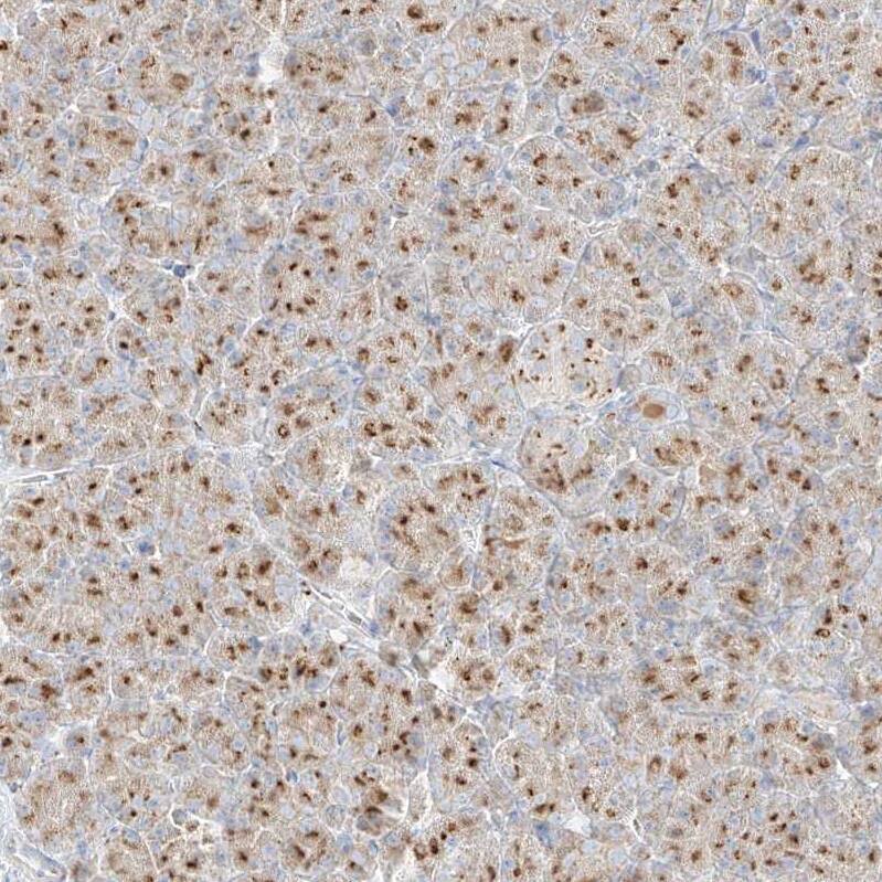 TMEM87B Antibody - BSA Free Immunohistochemistry: TMEM87B Antibody - BSA Free [NBP1-94006]