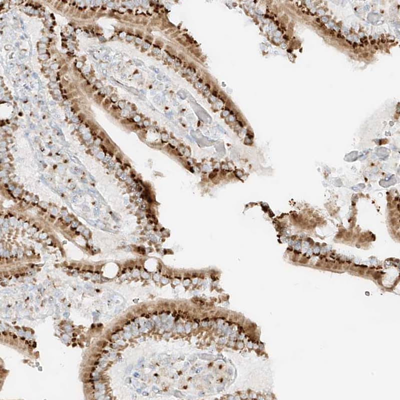 TMEM87B Antibody - BSA Free Immunohistochemistry: TMEM87B Antibody - BSA Free [NBP1-94006]