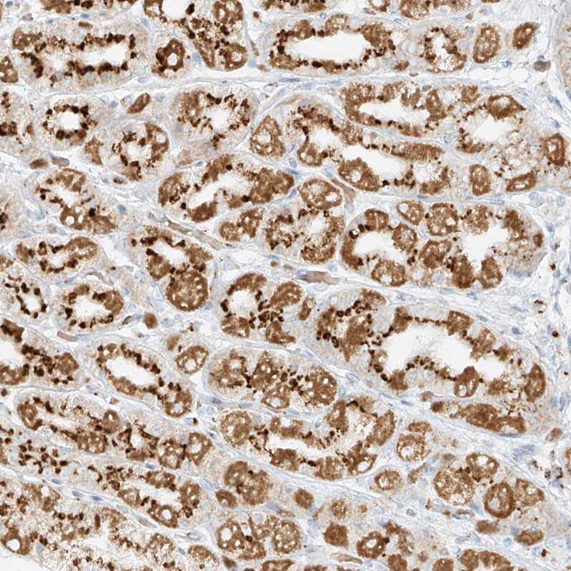 TMEM87B Antibody - BSA Free Immunohistochemistry: TMEM87B Antibody - BSA Free [NBP1-94006]