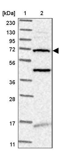TMEM87B Antibody - BSA Free Western Blot: TMEM87B Antibody - BSA Free [NBP1-94006]