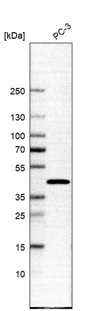 SLC35E1 Antibody - BSA Free Western Blot: SLC35E1 Antibody - BSA Free [NBP1-94009]