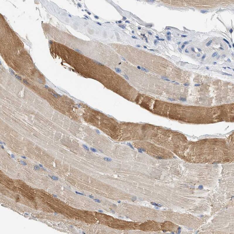 SLC35E1 Antibody - BSA Free Immunohistochemistry: SLC35E1 Antibody - BSA Free [NBP1-94009]
