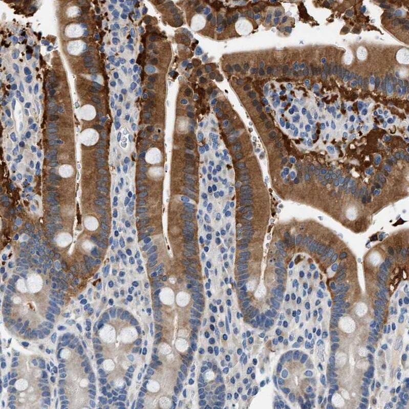 SLC35E1 Antibody - BSA Free Immunohistochemistry: SLC35E1 Antibody - BSA Free [NBP1-94009]