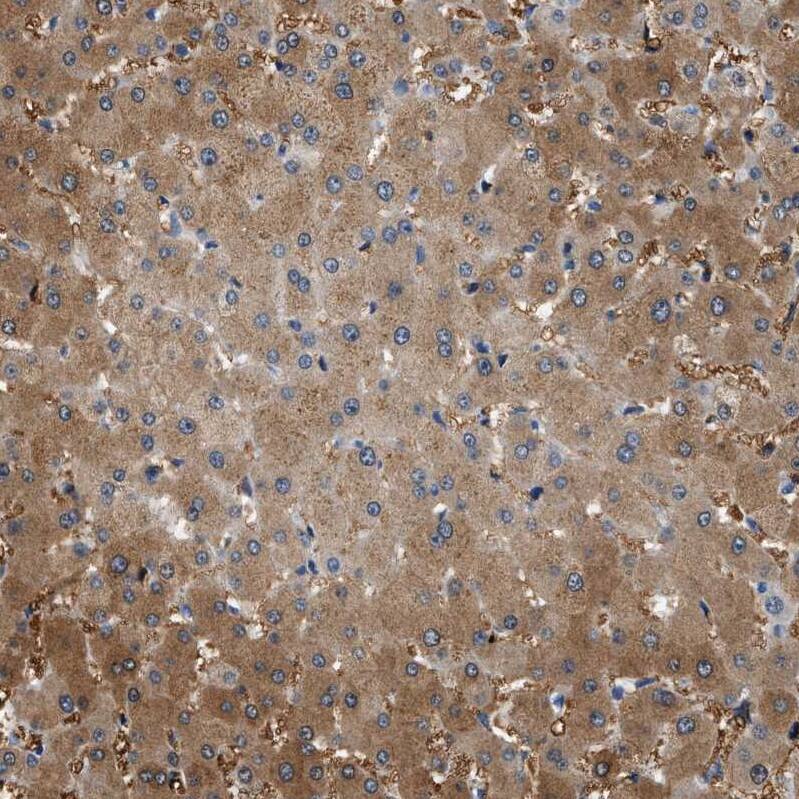 SLC35E1 Antibody - BSA Free Immunohistochemistry: SLC35E1 Antibody - BSA Free [NBP1-94009]