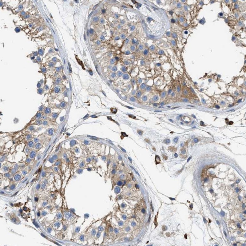 NSUN7 Antibody - BSA Free Immunohistochemistry: NSUN7 Antibody - BSA Free [NBP1-94011]