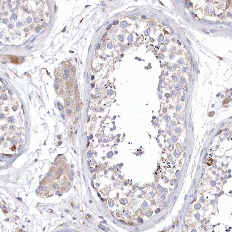 METTL8 Antibody - BSA Free Immunohistochemistry: METTL8 Antibody - BSA Free [NBP1-94012]