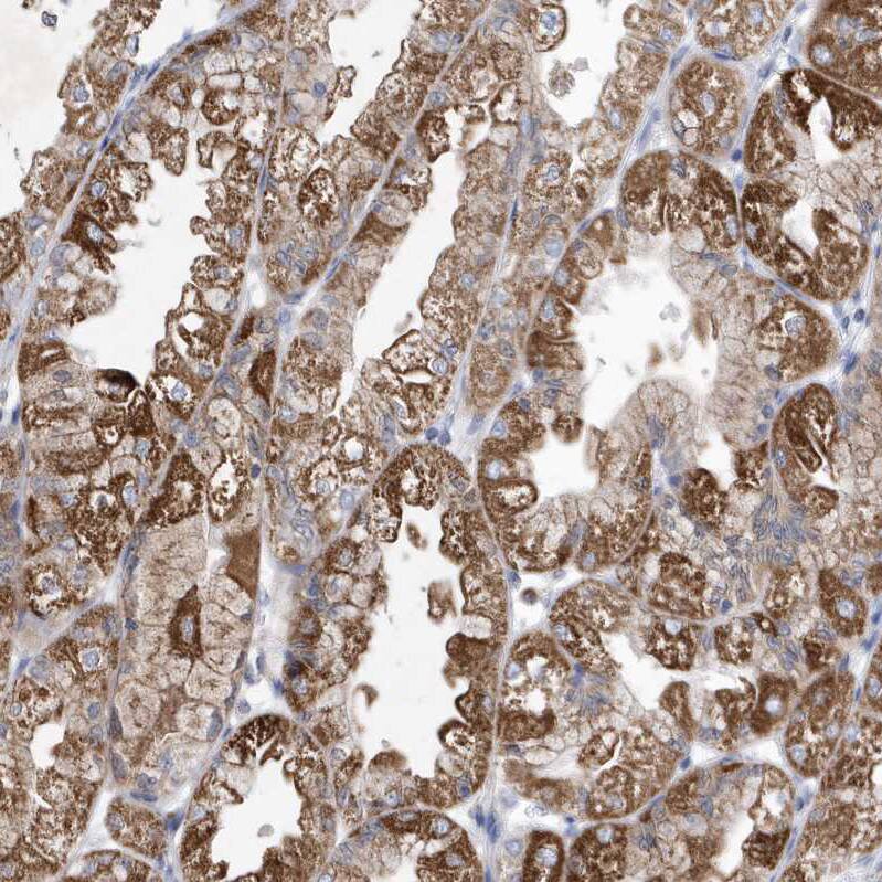 METTL8 Antibody - BSA Free Immunohistochemistry: METTL8 Antibody - BSA Free [NBP1-94012]