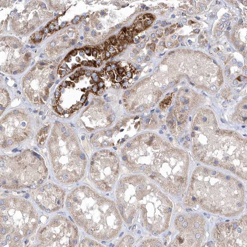 METTL8 Antibody - BSA Free Immunohistochemistry: METTL8 Antibody - BSA Free [NBP1-94012]