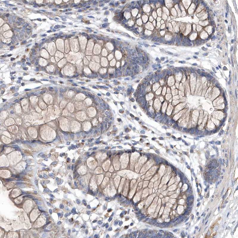 METTL8 Antibody - BSA Free Immunohistochemistry: METTL8 Antibody - BSA Free [NBP1-94012]