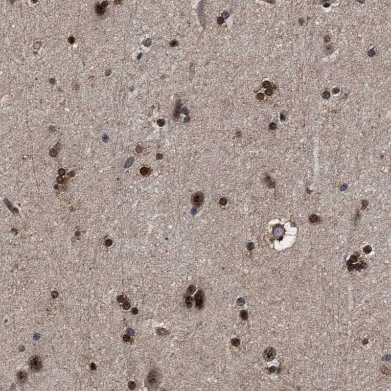 CAAP1 Antibody - BSA Free Immunohistochemistry: CAAP1 Antibody - BSA Free [NBP1-94018]