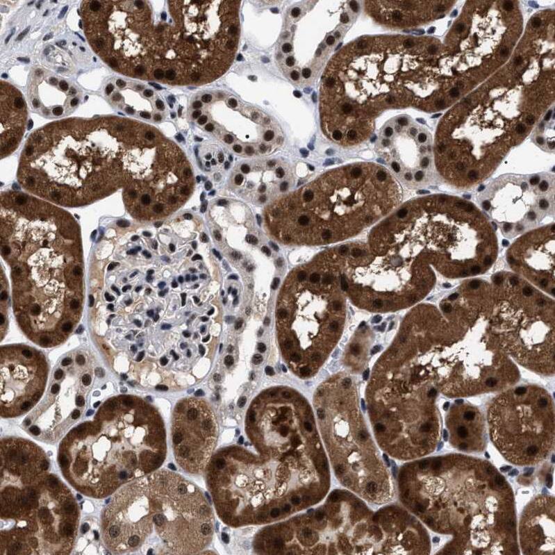 CAAP1 Antibody - BSA Free Immunohistochemistry: CAAP1 Antibody - BSA Free [NBP1-94018]