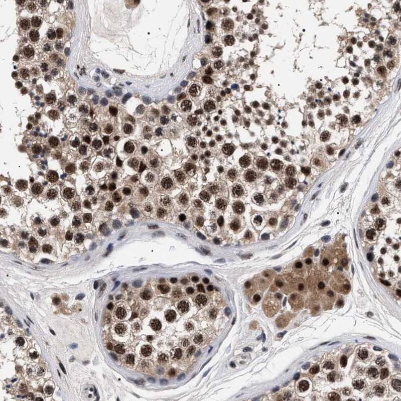 CAAP1 Antibody - BSA Free Immunohistochemistry: CAAP1 Antibody - BSA Free [NBP1-94018]