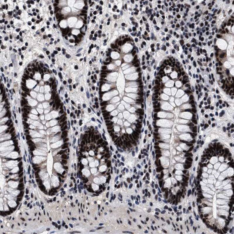 CAAP1 Antibody - BSA Free Immunohistochemistry: CAAP1 Antibody - BSA Free [NBP1-94018]