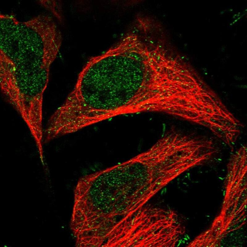 TRAPPC13 Antibody - BSA Free Immunocytochemistry/ Immunofluorescence: TRAPPC13 Antibody [NBP1-94021]